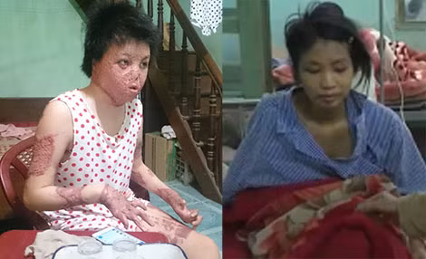 Một số nạn nhân của bạo hành gia đình: Nguyễn Thùy Dung (Thạch Thất, Hà Nội), Dương Thị Hiền (Lục Nam, Bắc Giang).