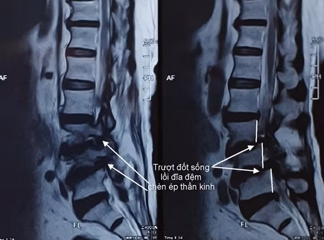 Hình ảnh MRI