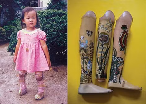 Mari Katayama lúc nhỏ và những chân giả nghệ thuật được trang trí bằng hình xăm nhiều màu sắc của Katayama.