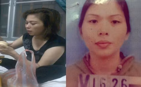 Chân dung Nguyễn Thị Thảo trước và sau khi phẫu thuật thẩm mỹ.