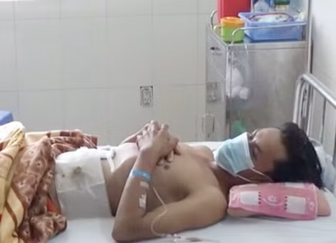 Người đàn ông bị lưỡi máy cắt cỏ đâm thủng bụng