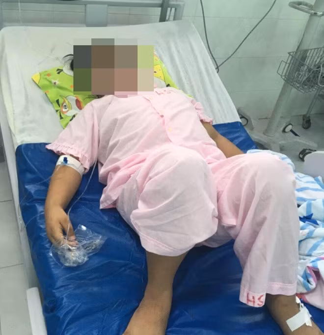 Bé gái 10 tuổi béo phì, bị viêm tụy cấp được BVNĐCT điều trị khỏi.