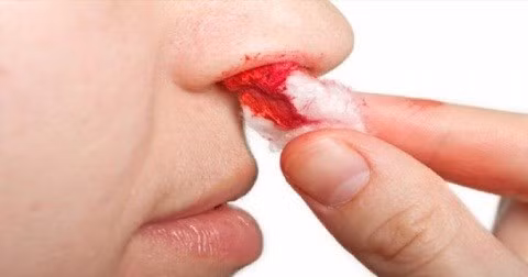 Chảy máu bất thường là một dấu hiệu không nên bỏ qua