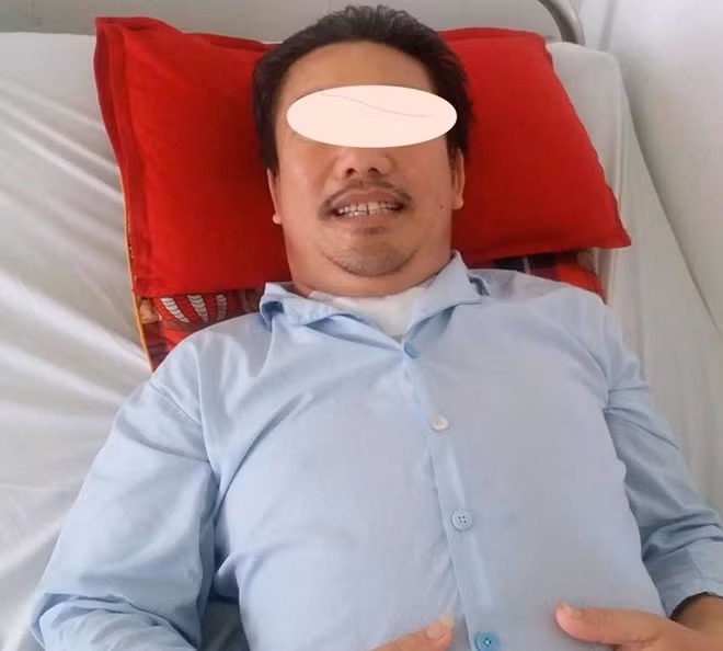 Bệnh nhân G được cứu sống sau khi được phẫu thuật, can thiệp đặt stent graft điều trị bóc tách động mạch chủ ngực.