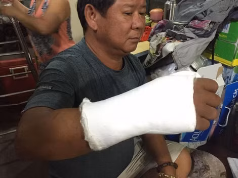 Những thương tích khá nghiêm trọng trên người ông Phong.