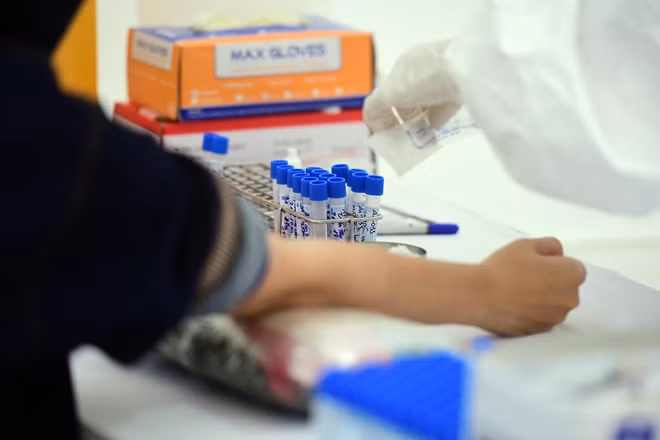 Bộ test do Hàn Quốc sản xuất và đang sử dụng, thông qua lẫy mẫu máu, cho kết quả trong 10 phút với độ chính xác cao. Trung tâm kiểm soát bệnh tật Hà Nội đã tiếp nhận 5.000 bộ test từ Bộ Y tế.