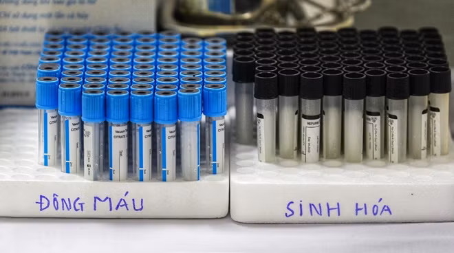 Loại vaccine COVID-19 sắp được tiêm thử nghiệm trên người có tên Nanocovax do Công ty Cổ phần Công nghệ Sinh học Dược NANOGEN nghiên cứu và sản xuất.