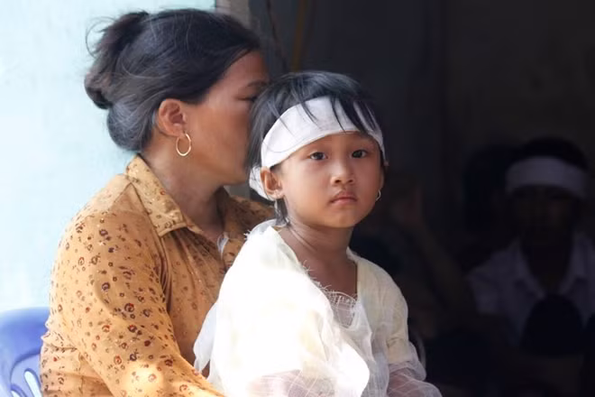 Bé Thảo còn quá nhỏ để cảm nhận được nỗi đau này.