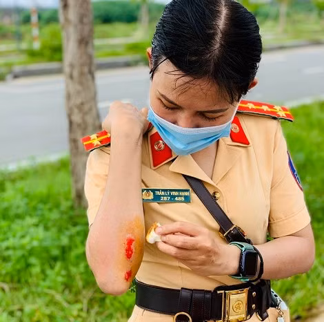 Đại úy Trần Lý Vinh Hạnh lúc bị ngã xe khi tập luyện.