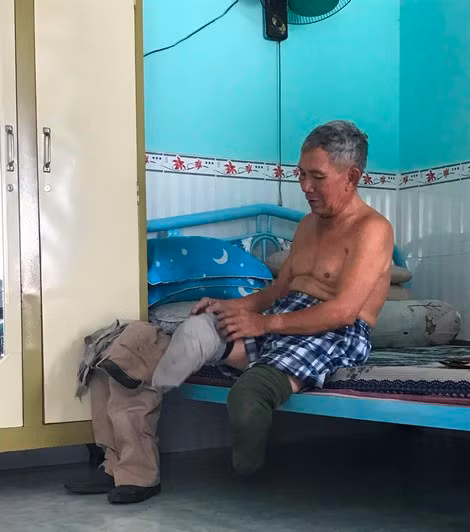 Đôi chân của ông phải lót rất nhiều giẻ để chống sưng và đau.