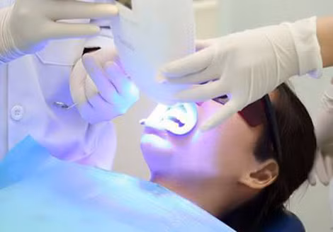 Tẩy trắng răng tại các cơ sở nha khoa vẫn là biện pháp an toàn nhất.