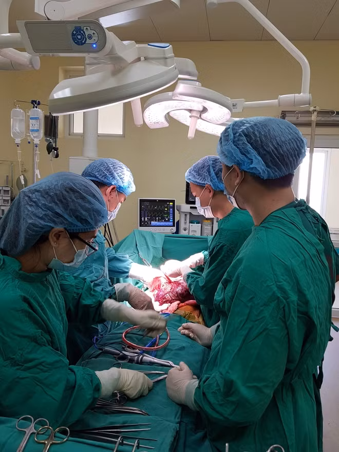 Các bác sĩ đang phẫu thuật bóc tách khối u cho bệnh nhân.