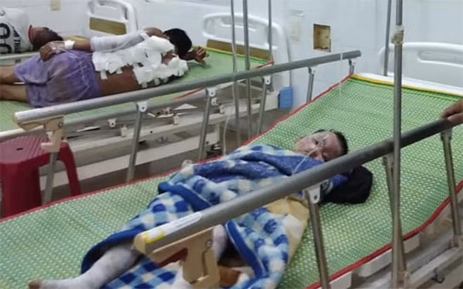 Hai cha con anh Sơn bị bỏng nặng được đưa đi cấp cứu.