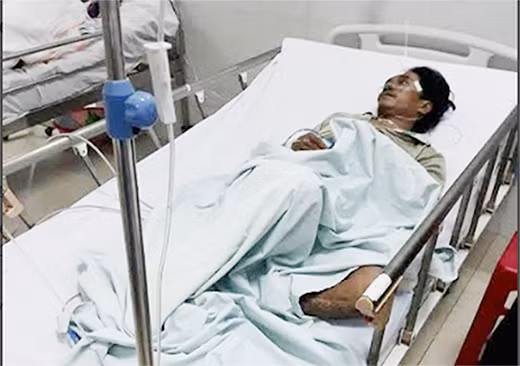 Một trường hợp người dân ở xã Cà Dy ngộ độc rượu được điều trị tại Trung tâm Y tế huyện Nam Giang