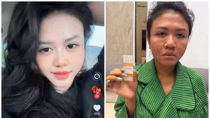 Bắt giữ TikToker Phannhibeauty sử dụng ma túy cùng giang hồ “Hoàng Nato”