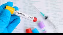 Giám sát chặt nguy cơ lây lan virus Marburg vào Việt Nam