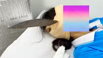 Nữ sinh đang ngồi uống nước, bất ngờ lưỡi dao găm vào đầu