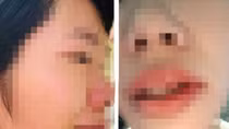 Con bị hạ hạnh kiểm, thầy giáo tìm đến nhà hành hung đồng nghiệp
