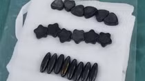Bé trai 10 tuổi nuốt 20 viên nam châm vì nghĩ là kẹo