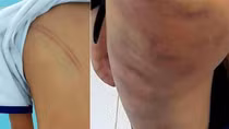 Khởi tố mẹ kế đánh con chồng