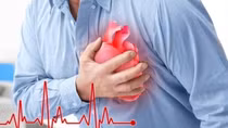 Cứu sống người đàn ông 52 tuổi bị sốc tim, ngừng tim