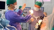 Bệnh nhân tỉnh táo hoàn toàn trong ca phẫu thuật kích thích não sâu