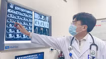 Cảnh báo đột tử khi liên tiếp có người bị lóc động mạch chủ cấp cứu