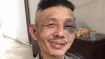 "Ngáo đá" liên tục chửi bới, đe dọa các nhà hàng xóm