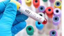 Điều kiện xác định người bị phơi nhiễm, nhiễm HIV do tai nạn rủi ro nghề nghiệp
