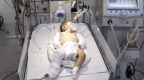 Bé gái 2 tháng tuổi gãy hai tay, chân, hôn mê sâu nghi bị bạo hành