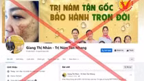 “Giang Thị Nhàn – trị nám tàn nhang” là lương y ảo