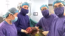 Mổ cắt khối u thận đa nang "khổng lồ" 2,8kg