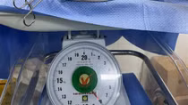 Mổ "bắt con" và bóc tách khối u buồng trứng 8kg cho sản phụ