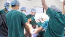 Lấy dị vật lọt vào vùng kín bé gái 8 tuổi