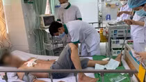 Thợ mộc bị thanh gỗ đâm xuyên qua vùng ngực