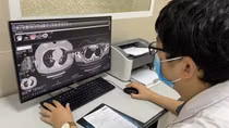 Hậu COVID-19 có 203 triệu chứng, tránh lạm dụng chỉ định không cần thiết