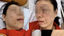 Điều tra đơn của người phụ nữ tố cáo bị chồng cũ bạo hành