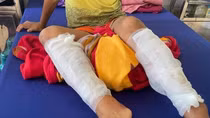 Cha ruột trói con rồi dùng xăng đốt chân