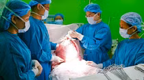 Bóc tách khối u như thai 9 tháng cho một nữ bệnh nhân