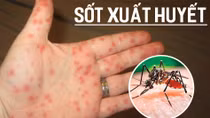 Phú Yên ghi nhận ca tử vong đầu tiên do sốt xuất huyết