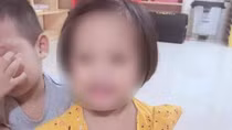 Bé gái 3 tuổi bị người tình của mẹ đóng đinh vào đầu đã tử vong
