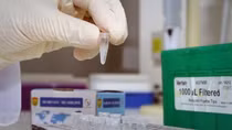 Bộ Y tế lí giải nguyên nhân giá kit test tăng