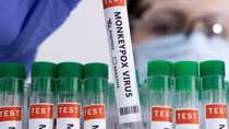 Có cần thiết phải tiêm vaccine đậu mùa khỉ?
