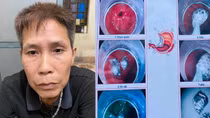 Gặp Công an, nuốt ma túy phi tang