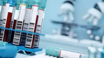 Nga cảnh báo một virus nguy hiểm lây lan mùa Thu tới
