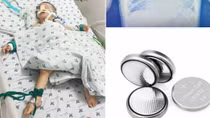 Bé trai 3 tuổi nguy kịch vì nuốt pin cúc áo