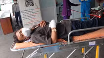 Mâu thuẫn với đối tượng ngồi trên xe khách chở F0 đi cách ly, một người đàn ông bị chém lìa tay