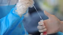 Hà Lan bắt nghi phạm mua bán virus SARS-CoV-2 qua bưu điện