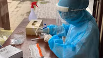 Giám sát chất lượng xét nghiệm SARS-CoV-2 để ứng phó với biến chủng mới Omicron