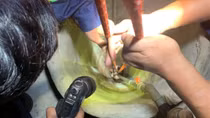 Gia Lai: Kịp thời cứu nạn cô gái rơi xuống giếng sâu